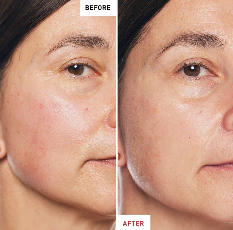 Erborian Skin Therapy Siero Bifasico Multi-Perfezionatore 30 ml